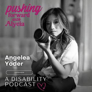 The Book Every Disabled Child Deserves: Angelea Yoder on Let Them Stare
