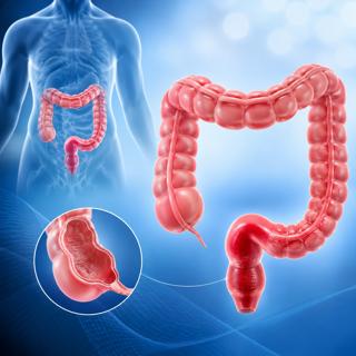 447. Surgical Management of Rectal Cancer - Part 2