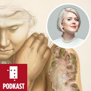 Ei natt med Venus, eit liv med Merkur. Støkken Dahl om syfilis