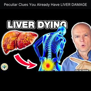 Peculiar Clues You Already Have LIVER DAMAGE