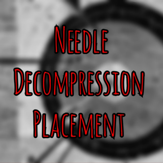Prolonged Field Care Podcast 240: Needle Decompression Placement