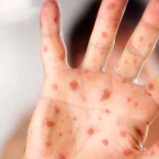 Measles Case Confirmed in North Carolina, Whistleblower Alleges DOJ Misconduct, North Carolina Bill Sparks Controversy, Consumer Confidence Plummets, and more...