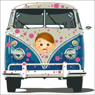 Episode 469: Chicken Pox Van