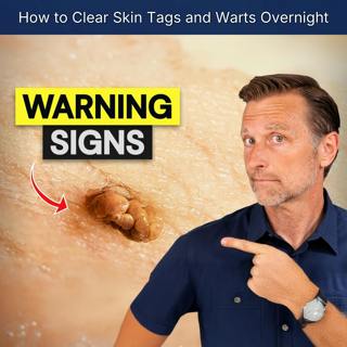 How to Clear Skin Tags and Warts Overnight