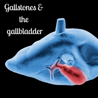 #110 Gallstones and the gallbladder