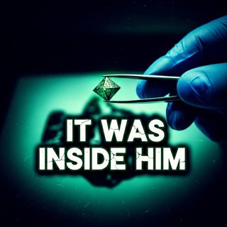 "Surgically Removed": Alien Implants & The Elite Team Hunting UFOs (Real Life X-Files)