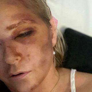 Virginia Giuffre Suicide | Another Epstein Victim Dead