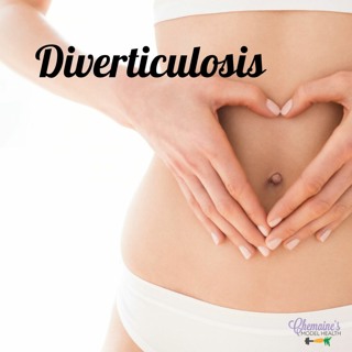 #188 Diverticulosis and Diverticulitis