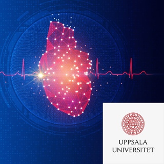 #76 AI kan ge säkrare hjärtdiagnoser