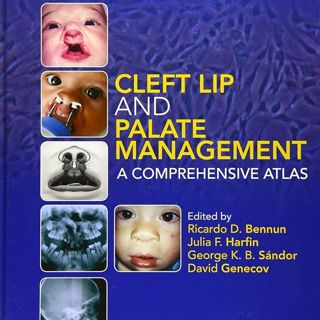Cleft Lip and Palate Management: A Comprehensive Atlas