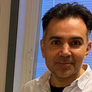 Neil Lagali forskar om ögonproblem efter covid-19