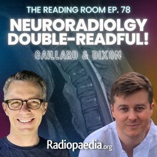 78. Neuroradiology double-readful!