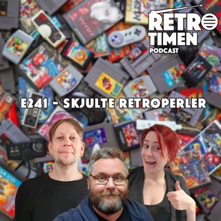 241 - Skjulte retroperler