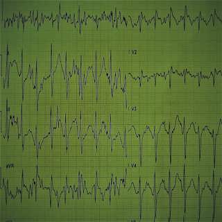 Slow Radio : Can You Anaesthetise a Worm? - full performance