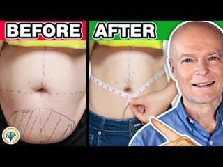 #1 Absolute Best Meal Plan To Lose Weight Faster