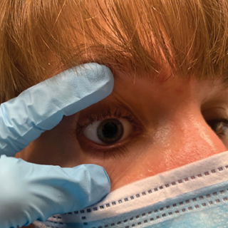 Maximizing Visible Retinal Area by Manual Eyelid Lifting When Using Ultra-Widefield Imaging