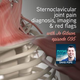 095. Sternoclavicular joint pain diagnosis, imaging & red flags with Jo Gibson