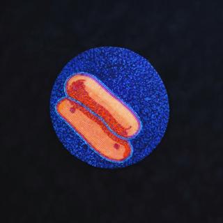 Ep 37: TB Stories - What it Takes