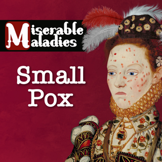 Tudor Time Machine Miserable Maladies: Smallpox