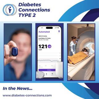 In the News... Omnipod 5 iPhone update, Libre & Dexcom news, overnight insulin pump and more!