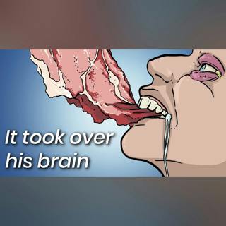 A Man Ate Undercooked Pork, This Is What Doctors Found Inside His Brain