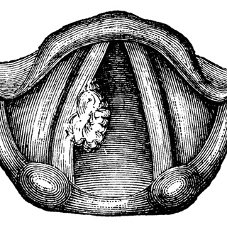 From Silence to Survival: 150 Years of Laryngectomy and the Future of Voice