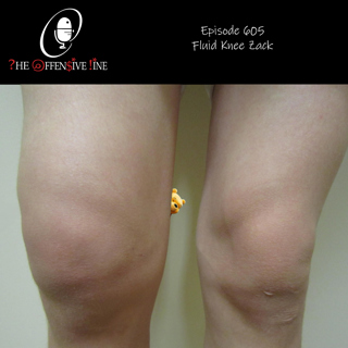 Episode 605 - Fluid Knee Zack