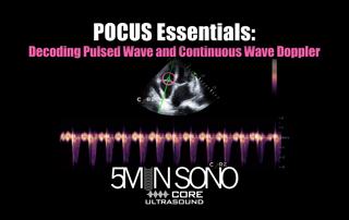 POCUS Essentials: Decoding Pulsed Wave and Continuous Wave Doppler