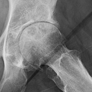 It's All in the Hip
