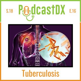 Tuberculosis Resurgence