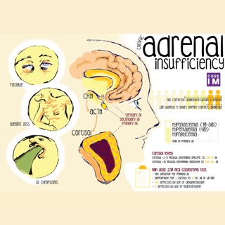 #13 Chronic Adrenal Insufficiency: 5 Pearls segment