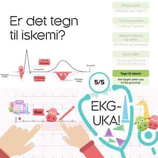 05 Er det tegn til iskemi?