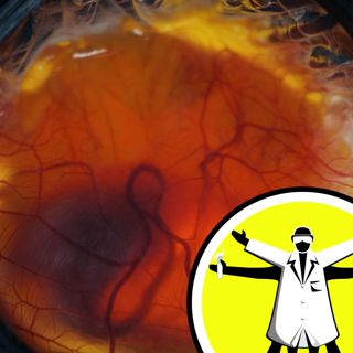 Rising melanoma rates, and artificial bird's eggs