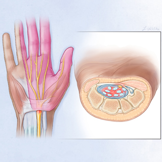 Diagnosis and Treatment of Common Hand Conditions