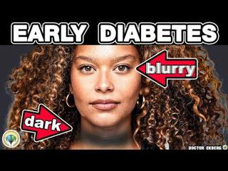10 Early Diabetes Signs You Must Not Ignore 