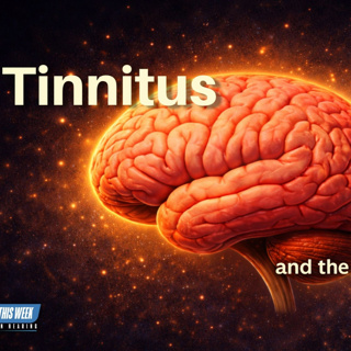 329 - A Brain-Based Approach to Understanding and Managing Tinnitus