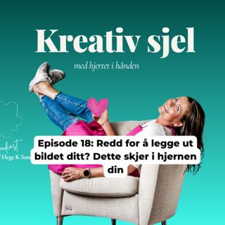 Redd for å legge ut bildet ditt? Dette skjer i hjernen din