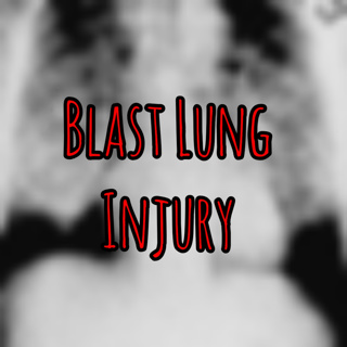 PFC Podcast 282: Blast Lung - Expert Tactics for Blast Lung Injury in Prolonged Field Care