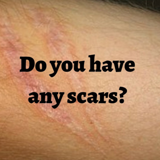 Do you have any scars?