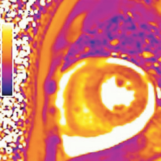 Association of Coronavirus Disease 2019 (COVID-19) With Myocardial Injury and Mortality