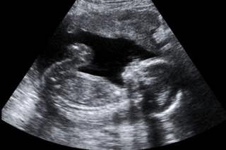 Seeking Support: Miscarriage and Infant Loss