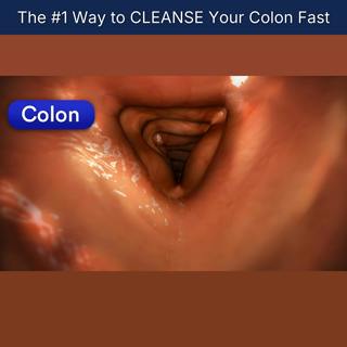 The #1 Way to CLEANSE Your Colon Fast