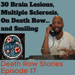 30 Brain Lesions, Multiple Sclerosis, On Death Row… and Smiling (with names withdrawed)