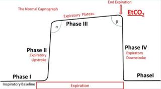 On the Streets #9: Advanced Applications of Capnography