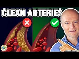 Top 10 Foods To Unclog Arteries Naturally & Prevent Heart Attack