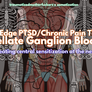 Bite Sized! Stellate Ganglion Treatment, Chronic Pain, and Unresponsive PTSD