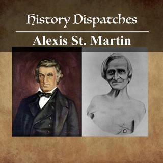 Alexis St. Martin and the gunshot that changed science