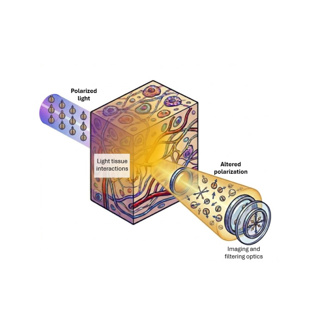 Seeing the Invisible: How Polarized Light Contributes to Our Understanding and Detection of Cancer
