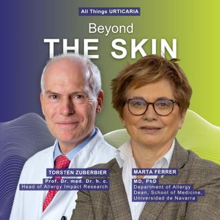Urticaria as a Systemic Disease