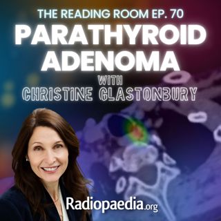 70. Readful! Parathyroid adenoma with Christine Glastonbury